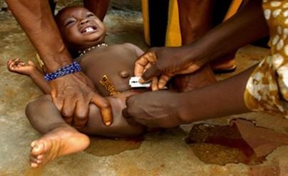 STOP FEMALE GENITAL MUTILATION IN IMO STATE: IT IS AGAINST THE LAW IN IMO STATE